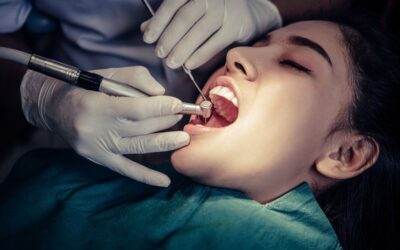 Wisdom Teeth: Why and When Tooth Removal Is Necessary