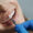 Porcelain Veneers