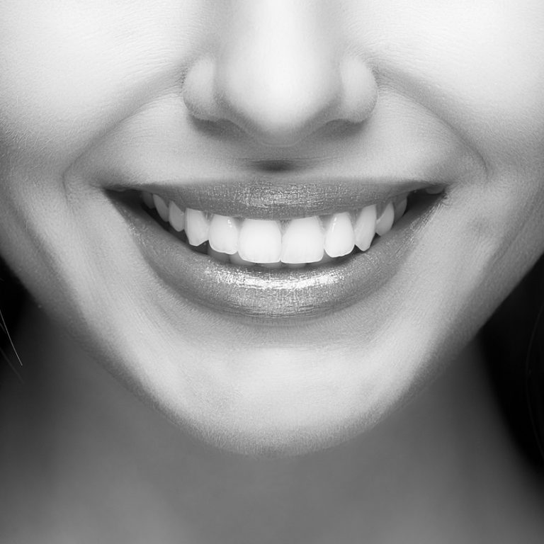 Beautiful woman smile. Teeth whitening. Dental care.