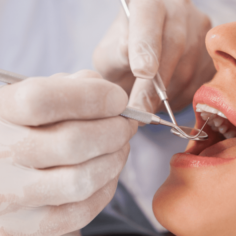 GentleDental_PreventionDentalCleaning