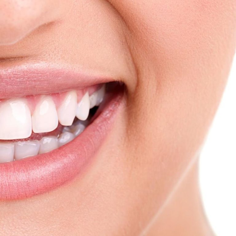 Orthodontics - Gentle Dental Hervey Bay